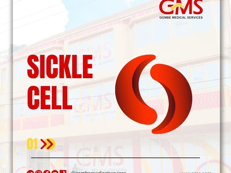 GMS Hospital sickle cell health information
